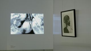 An der hinteren Wand eines Ausstellungsraums die Nahaufnahme eines Gehirns. An der rechten Wand das Röntgenbild eines Menschen im Profil.
