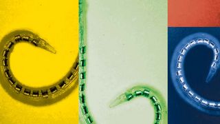 Ein Bild, das in drei Farbflächen (gelb, grün, blau) geteilt ist. Links und rechts ist jeweils ein Stück von einem Krakenarm zu sehen.