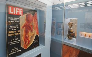 Das Cover der Zeitschrift Life mit dem Bild eines ungeborenen Babys. Im Hintergrund ist die Gläserne Schwangere in einer Vitrine.