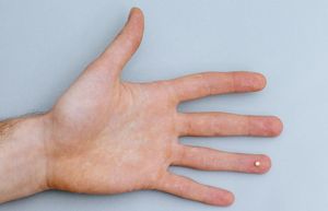 Innenfläche einer Hand mit einem Chip auf dem Ringfinger